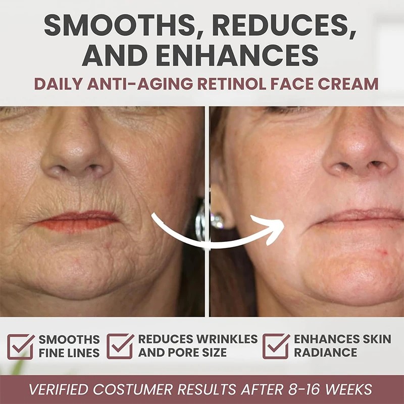 Instant Retinol Cream Wrinkle Remover - Firming, Lifting, and Anti-Aging Solution for Radiant Skin