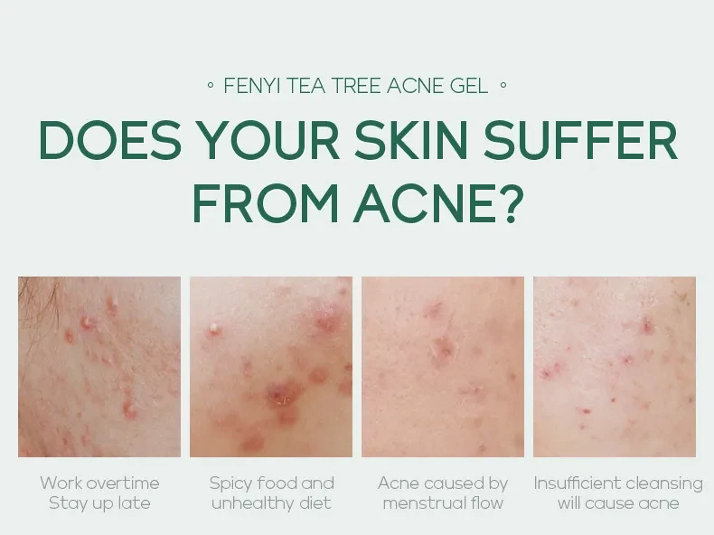 20g Moisturizing Skin Care