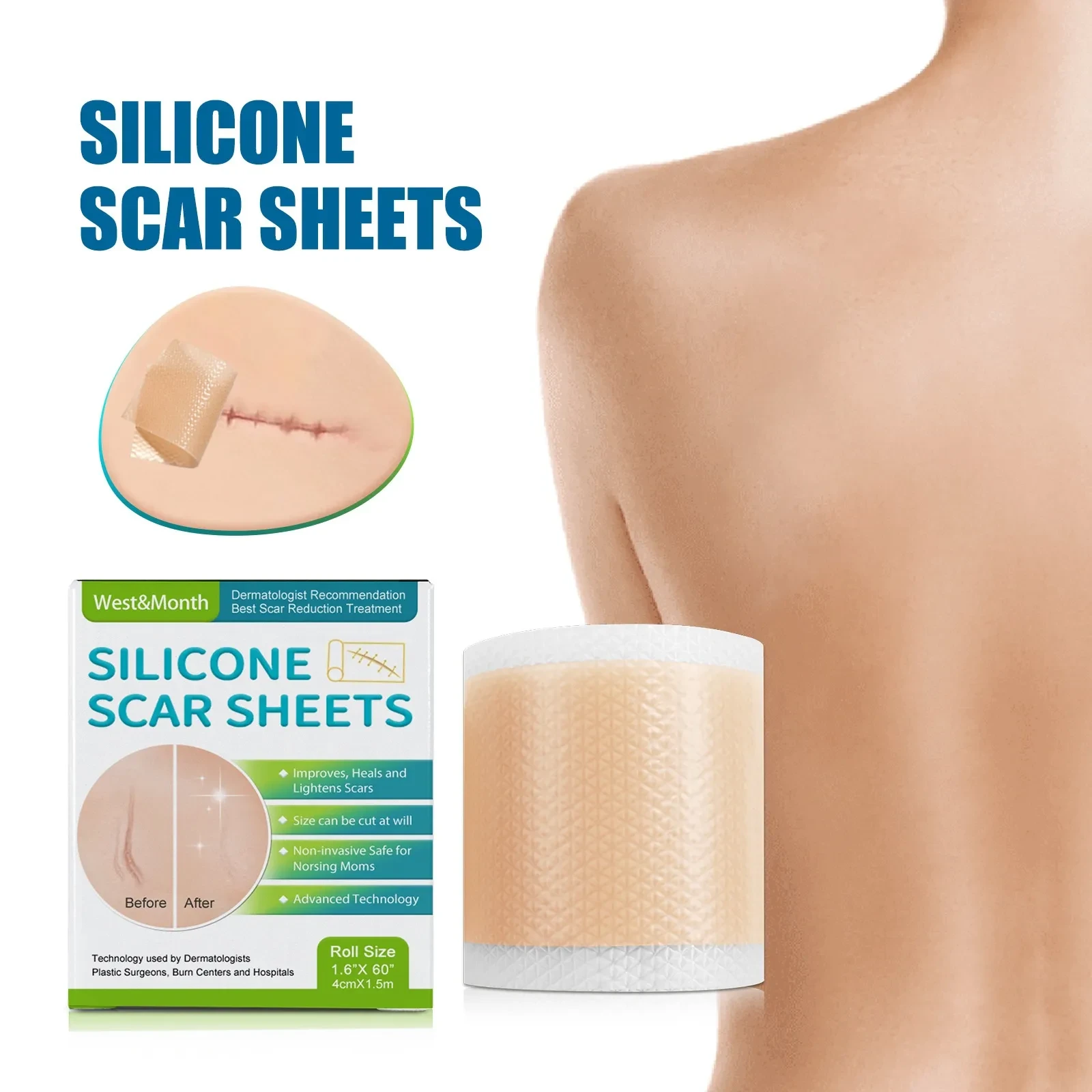 silicone scar sheets