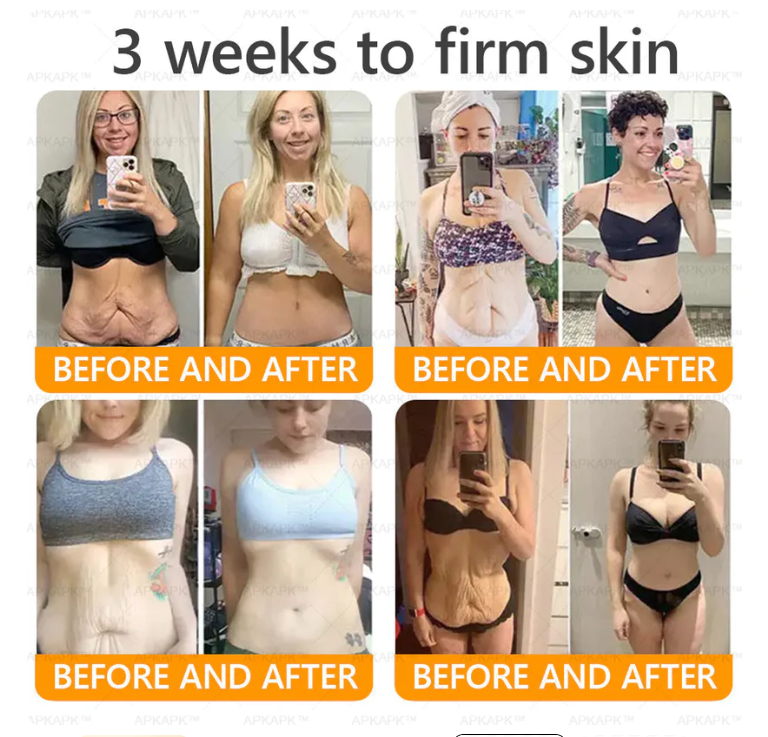 AWZLOVE Bee Venom Comprehensive Cream