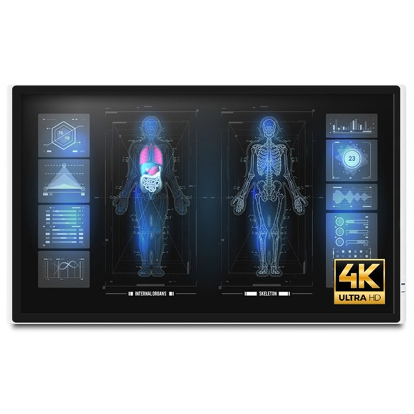 Onyx MEDDP-632-P1 32" 4K Medical Touch Display