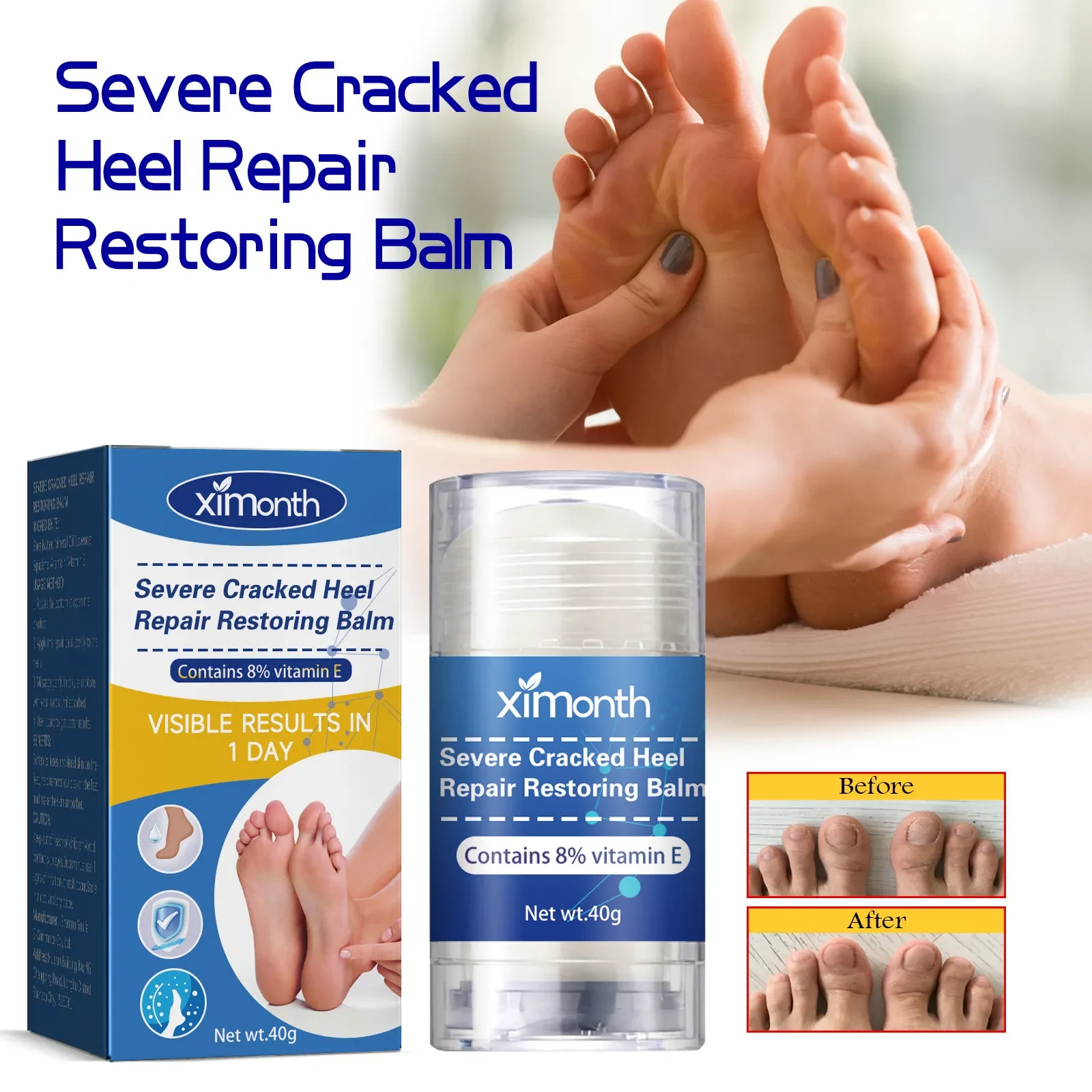 XIMONTH Severe Cracked Heel Repair Restoring Balm