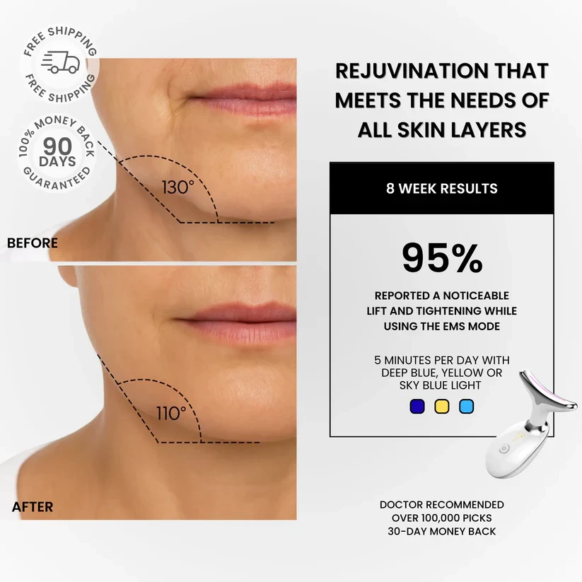 VitaLift Zaven Facial Sculptor