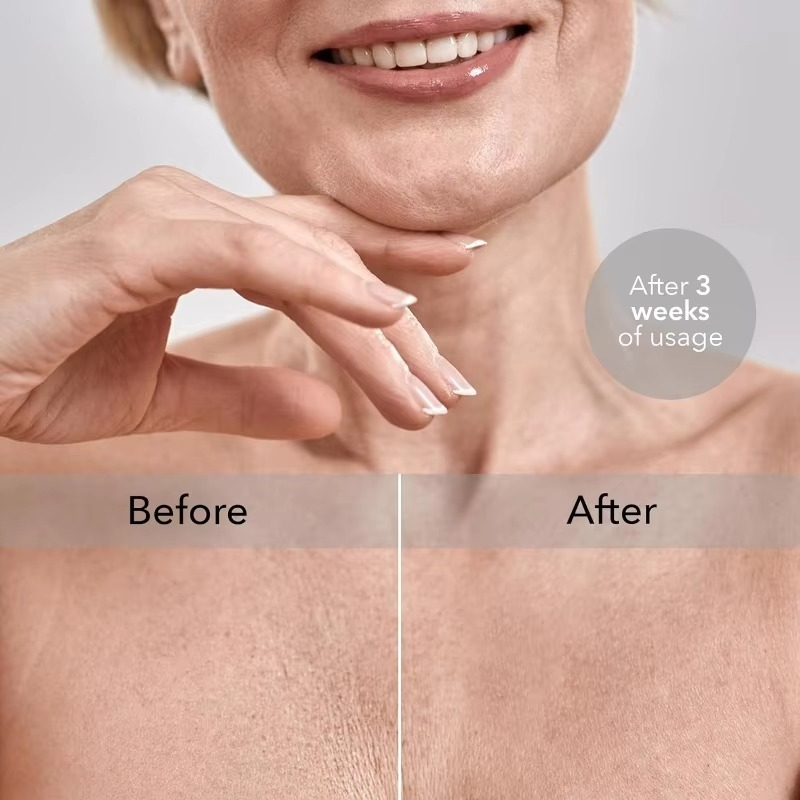 SilkRest Breast Support Pillow  Anti-Wrinkle Chest Pillow for Side Sleeping