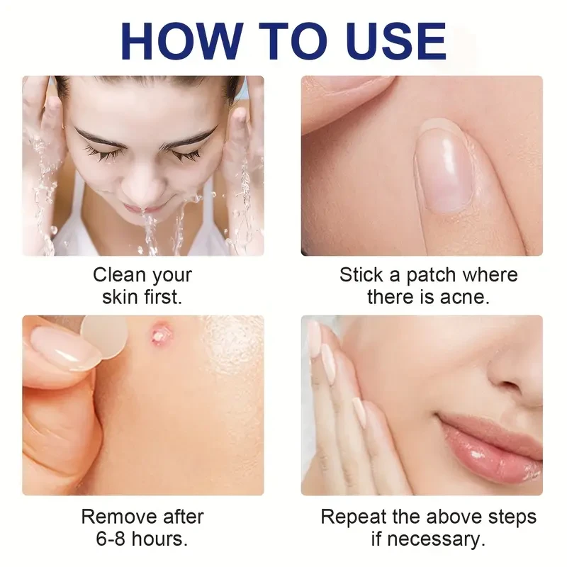 LANEMAY 78pcs Pimple Patch Set  Hydrocolloid Day & Night Acne Cover Patches