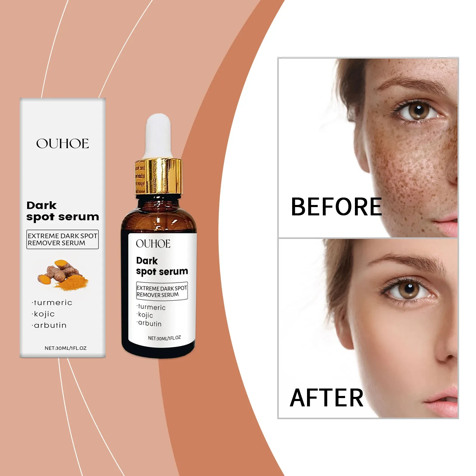 Ouhoe Dark Spot Serum