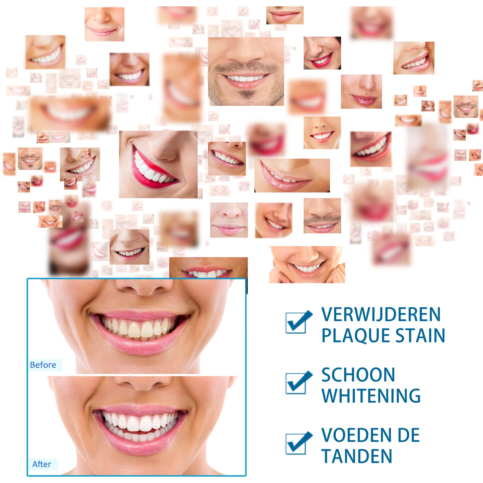 Jaysuing Teeth Whitening Tooth Brush  Instant Brightening Solution