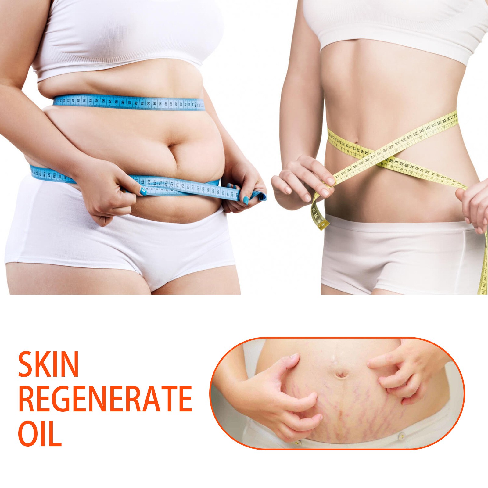 Jaysuing Skin Regenerate Oil  Stretch Mark & Scar Treatment