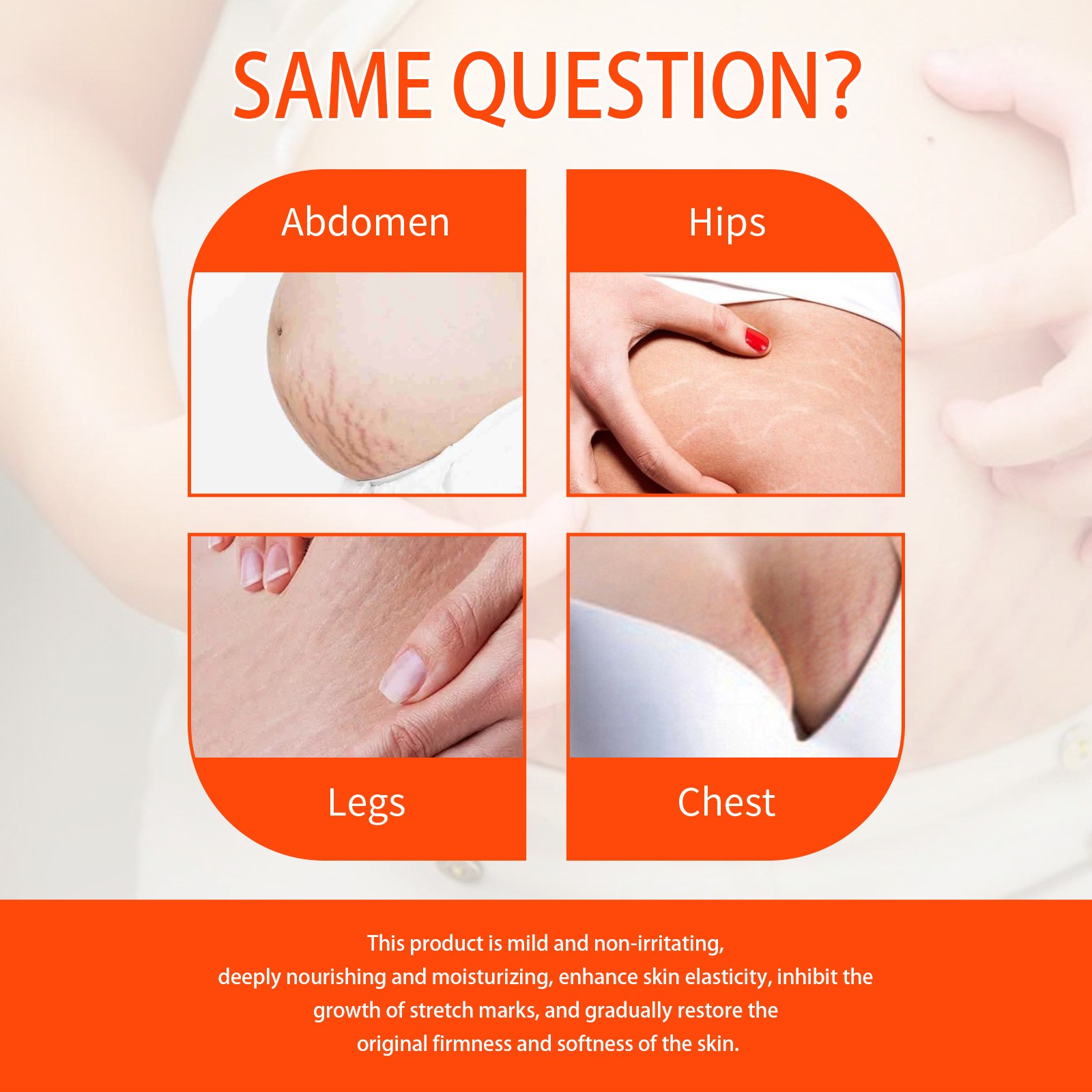 Jaysuing Skin Regenerate Oil  Stretch Mark & Scar Treatment