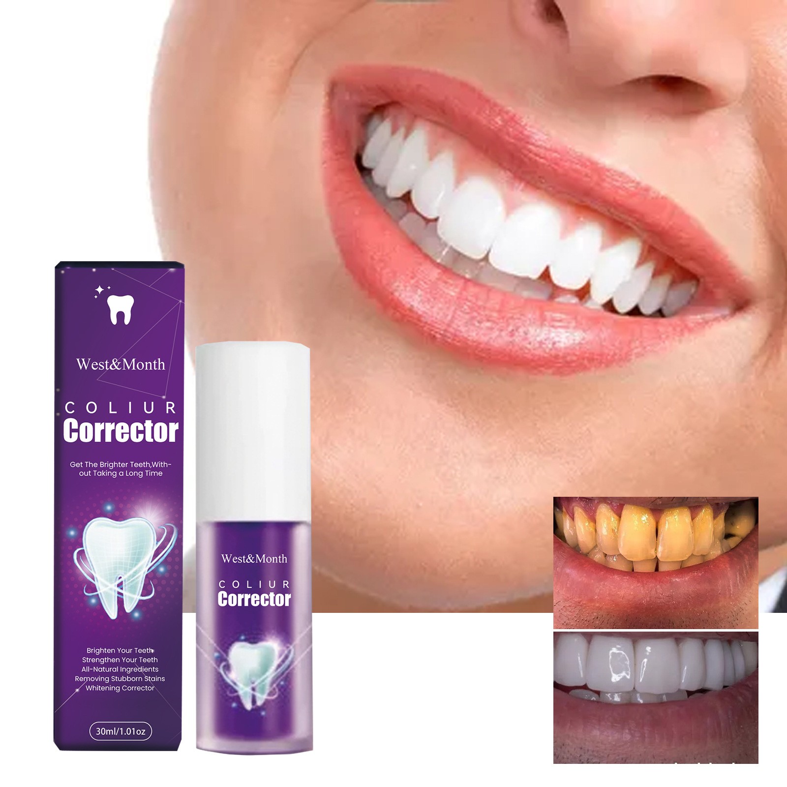 West&Month Coliur Teeth Whitener Corrector  Brighten Your Smile in Minutes