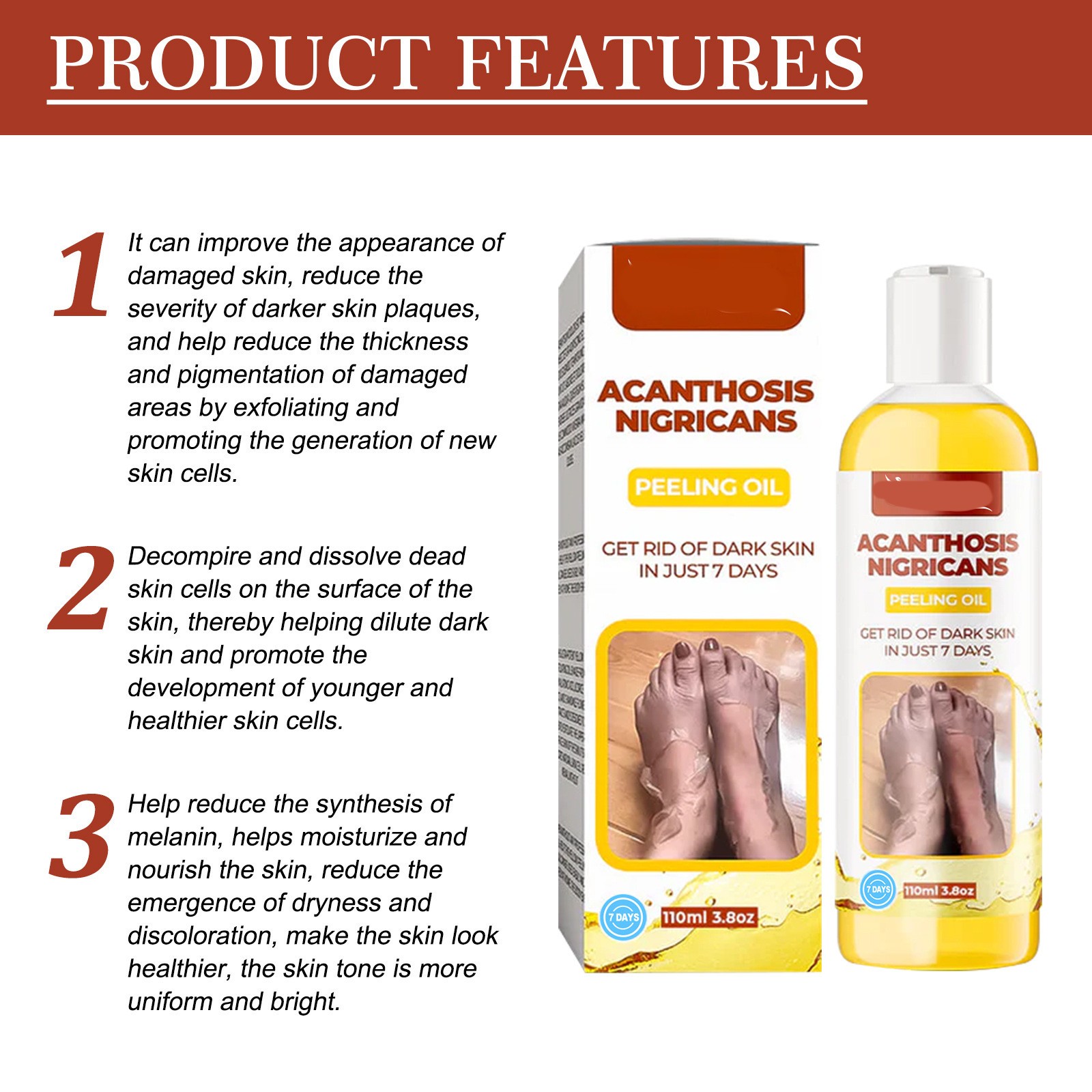 Acanthosis Nigricans Peeling Oil  Remove Dark Skin in Just 7 Days