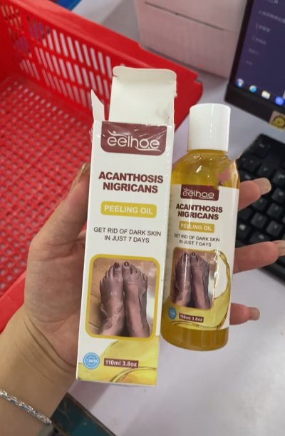 Acanthosis Nigricans Peeling Oil  Remove Dark Skin in Just 7 Days