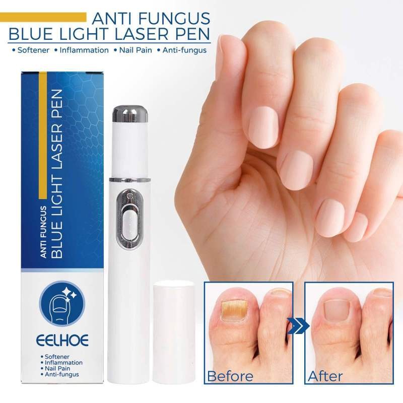 EELHOE Anti Fungus Blue Light Laser Pen