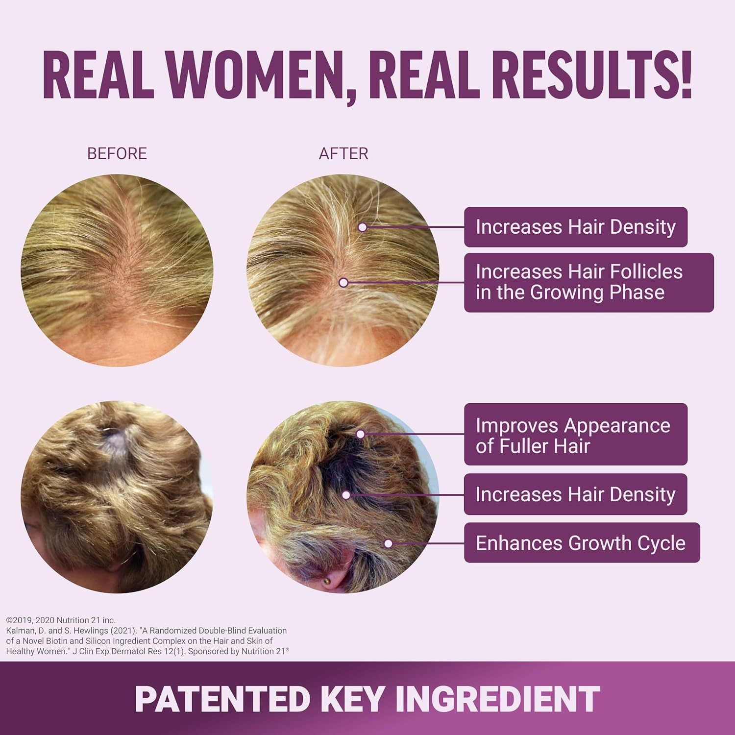 Hair Growth Accelerator Promote Thicker, Fuller, and Healthier Hair Naturally