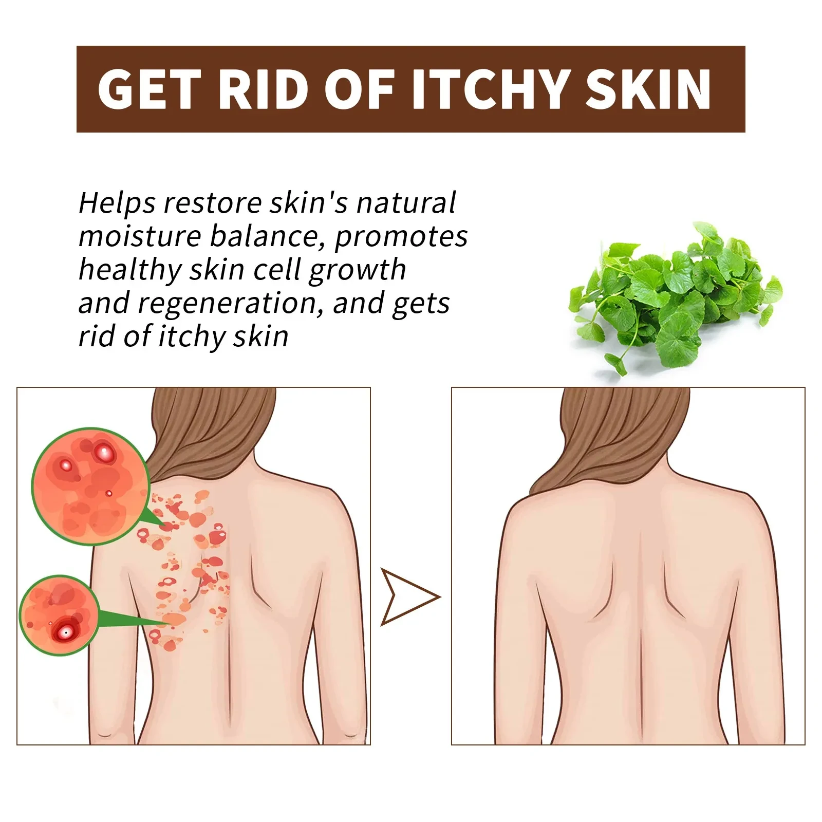 Skin Moss Repair Essential Oil Relieves Itching