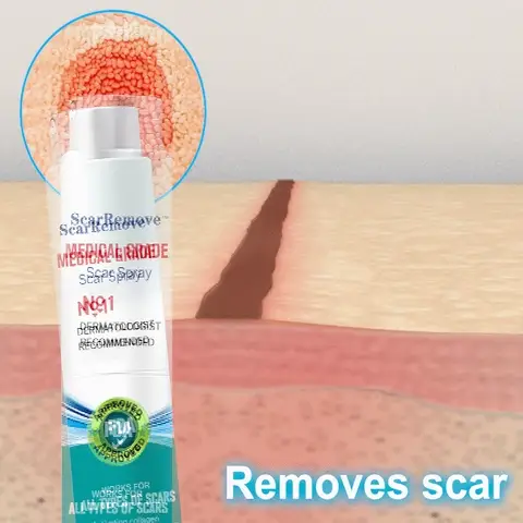 Advanced Scar Spray For All Types of Scars - For example Acne Scars, Surgical Scars and Stretch Marks