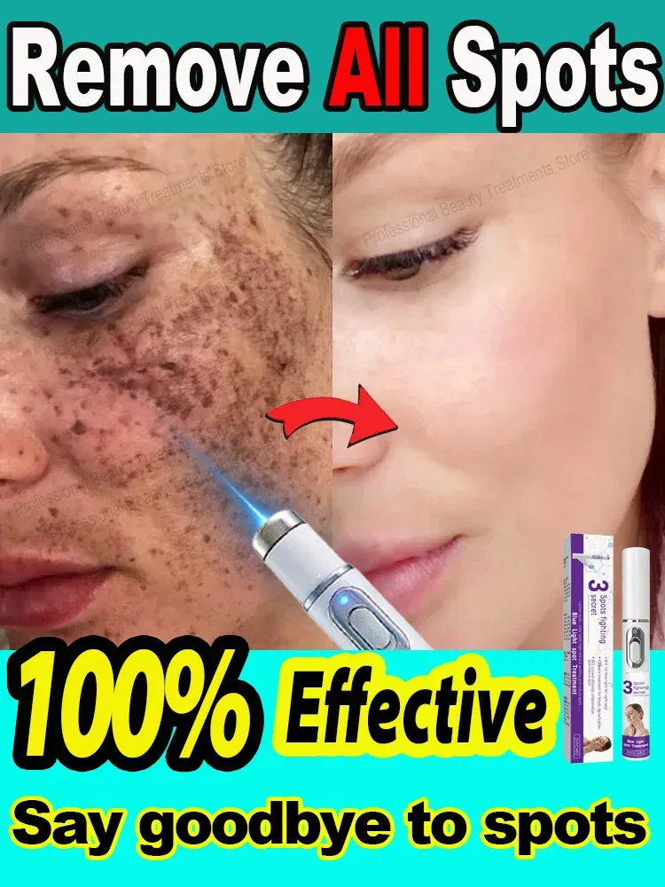 Color: black - ?โฆ?ยซ๐๐?ยค๐ฅ๐ ?ยซ๐?ยฆ๐จ๐ฏ๐๐ฅ Laser Therapy to Heal Spots