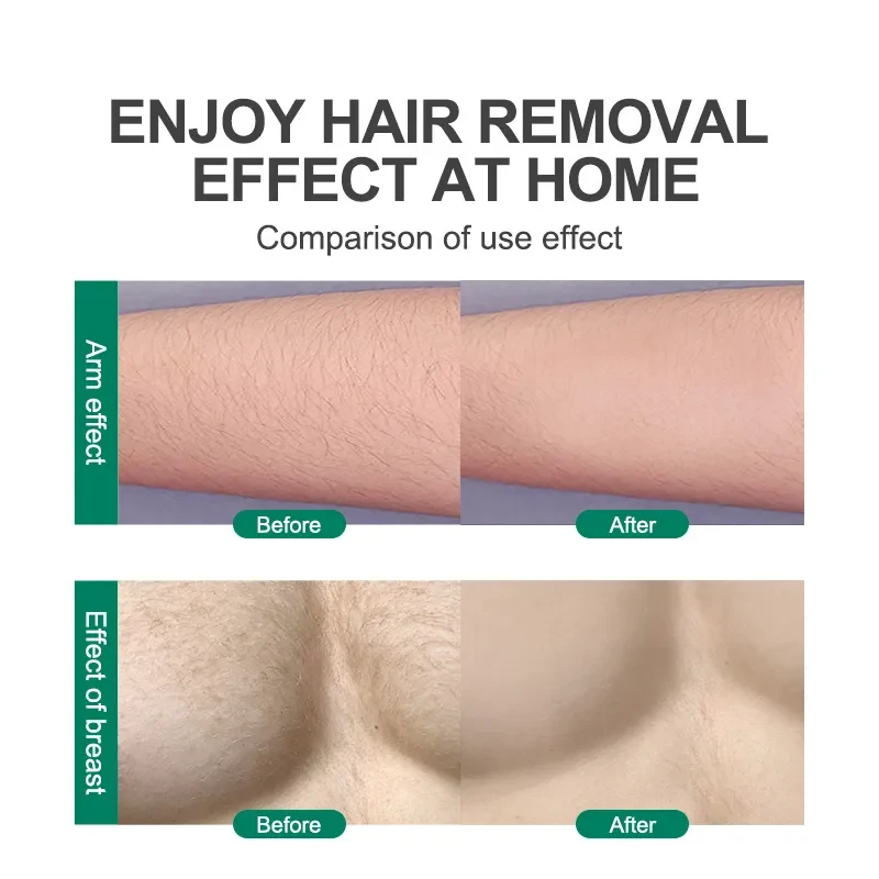 Crystal Hair Removal