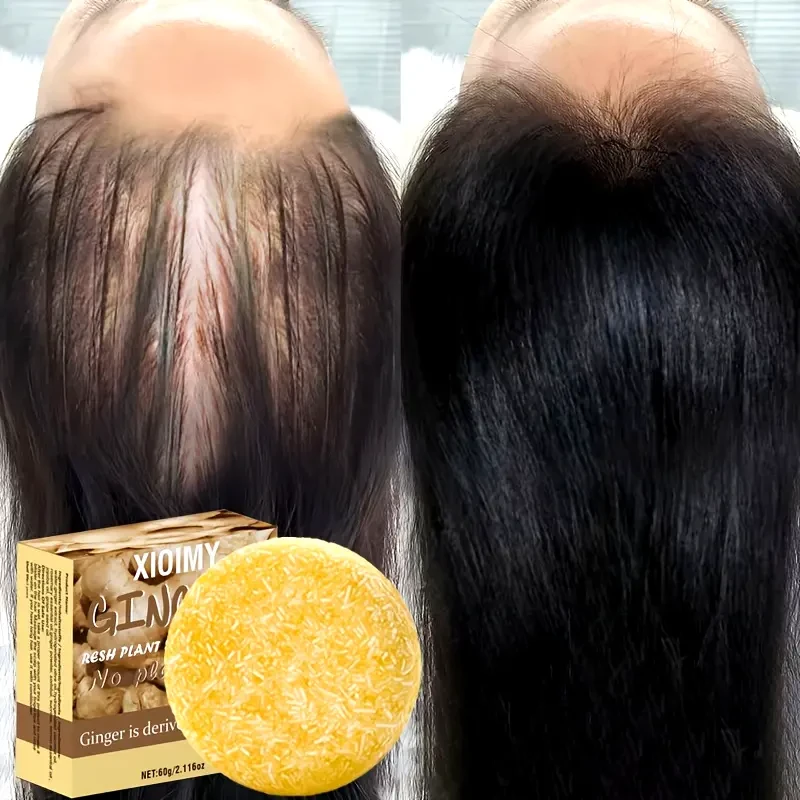 Xioimy Luxurious Ginger Shampoo Bar
