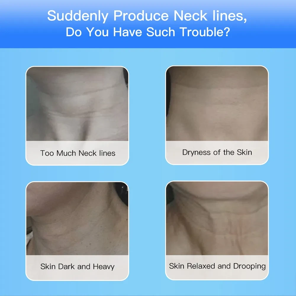 Microcurrent Neck Face Beauty Device