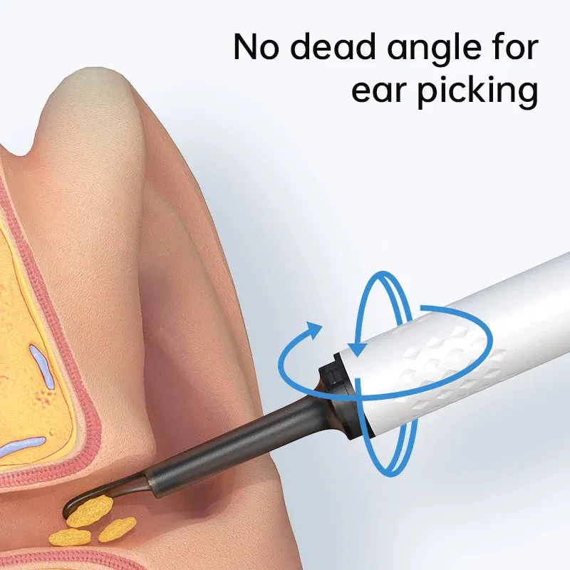 Color: multi - Visual Ear Cleaner With Camera 6 LED Lights 4.0mm Lens Ear Wax Removal Tool ?‹500W Pixel Camera Take Video 500W HD Earpick Gifts