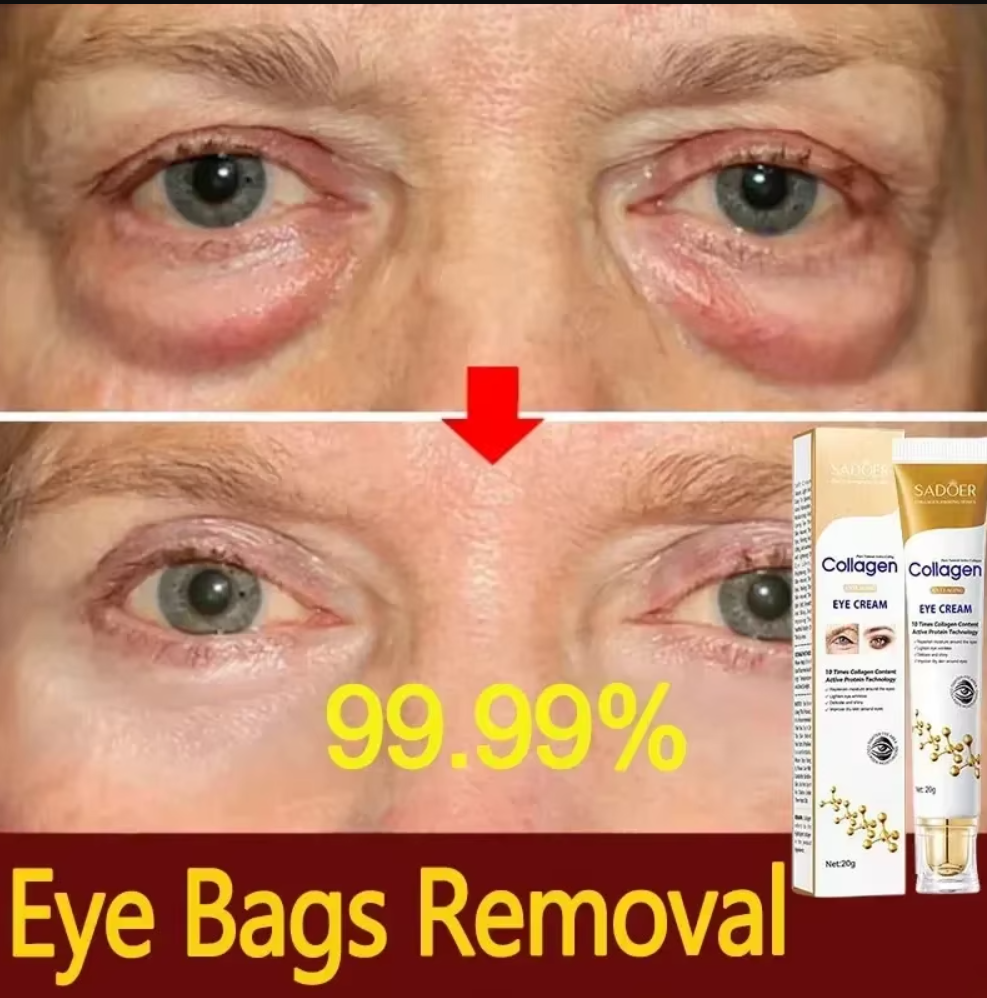 Fast-acting Eye Bag Removal