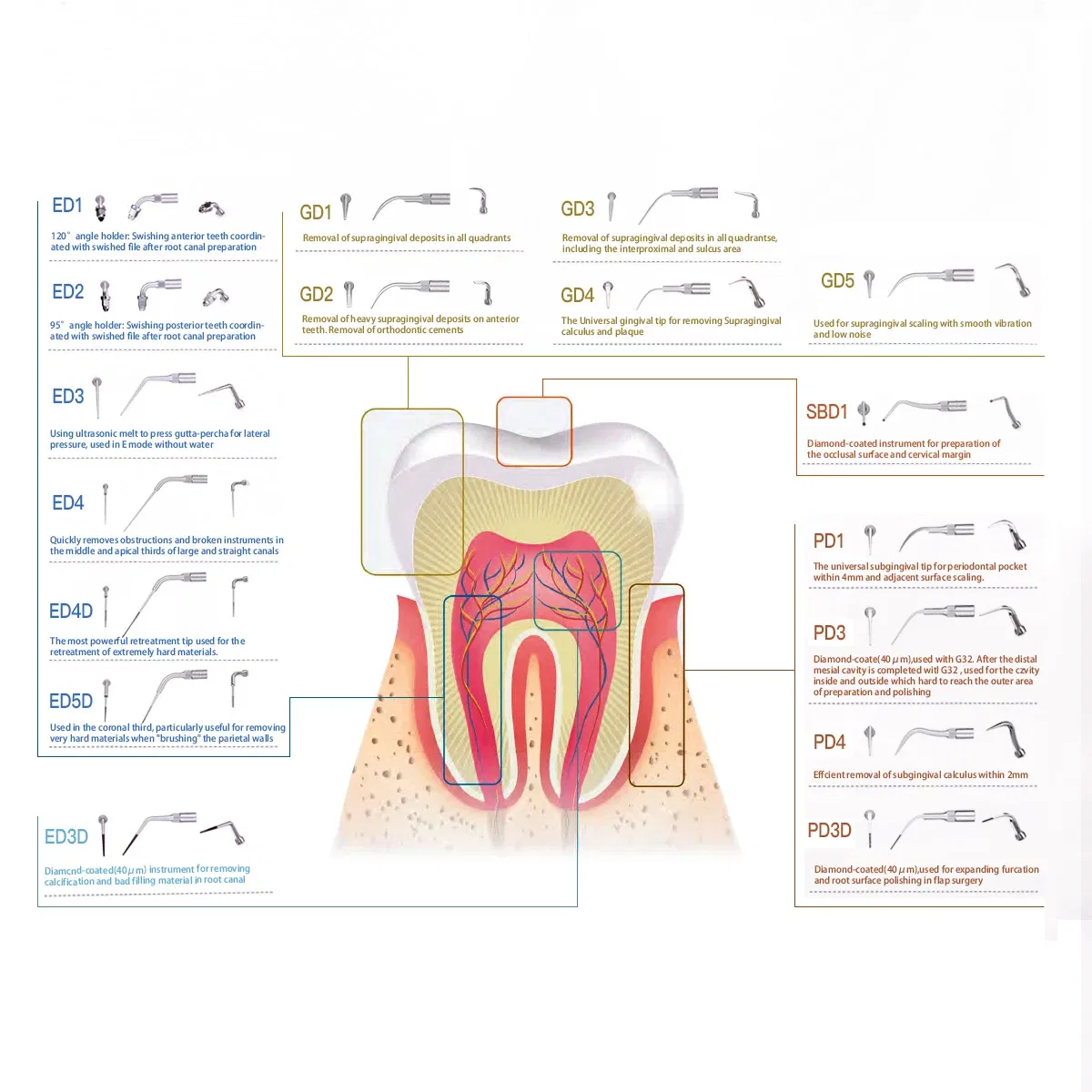 Color: Silver, Ships From: CHINA - AZDENT 1pc Dental Ultrasonic Scaler Tip Scaling Periodontics Endodontics GD PD ED Tip Fit for SATELEC DTE NSK Ultrasonic Scaler