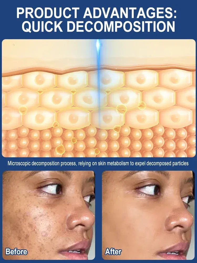 Color: green - ?โฆ?ยซ๐๐?ยค๐ฅ๐ ?ยซ๐?ยฆ๐จ๐ฏ๐๐ฅ Laser Therapy to Heal Spots