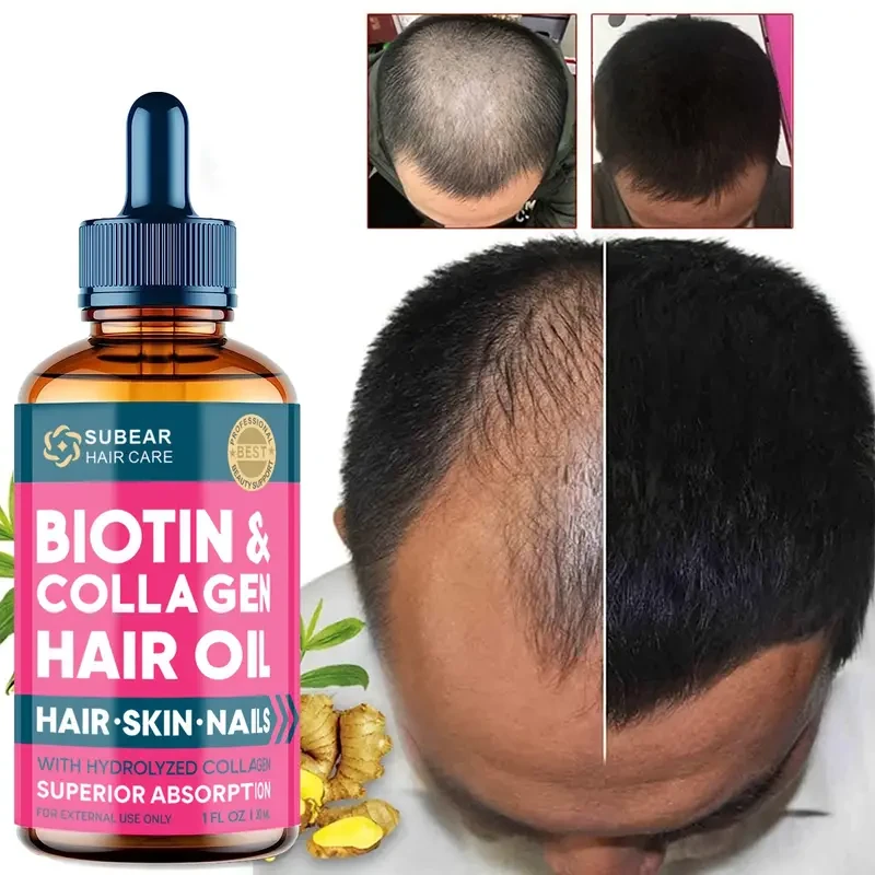 Liquid Biotin & Collagen - Hair Oil For Hair Growth Support For Women & Men - Strong Nails & Healthy Skin - Hair Regrowth Treatment For Scalp Hair Loss Hair Thinning For Thicker Longer Fuller Healthier Hair