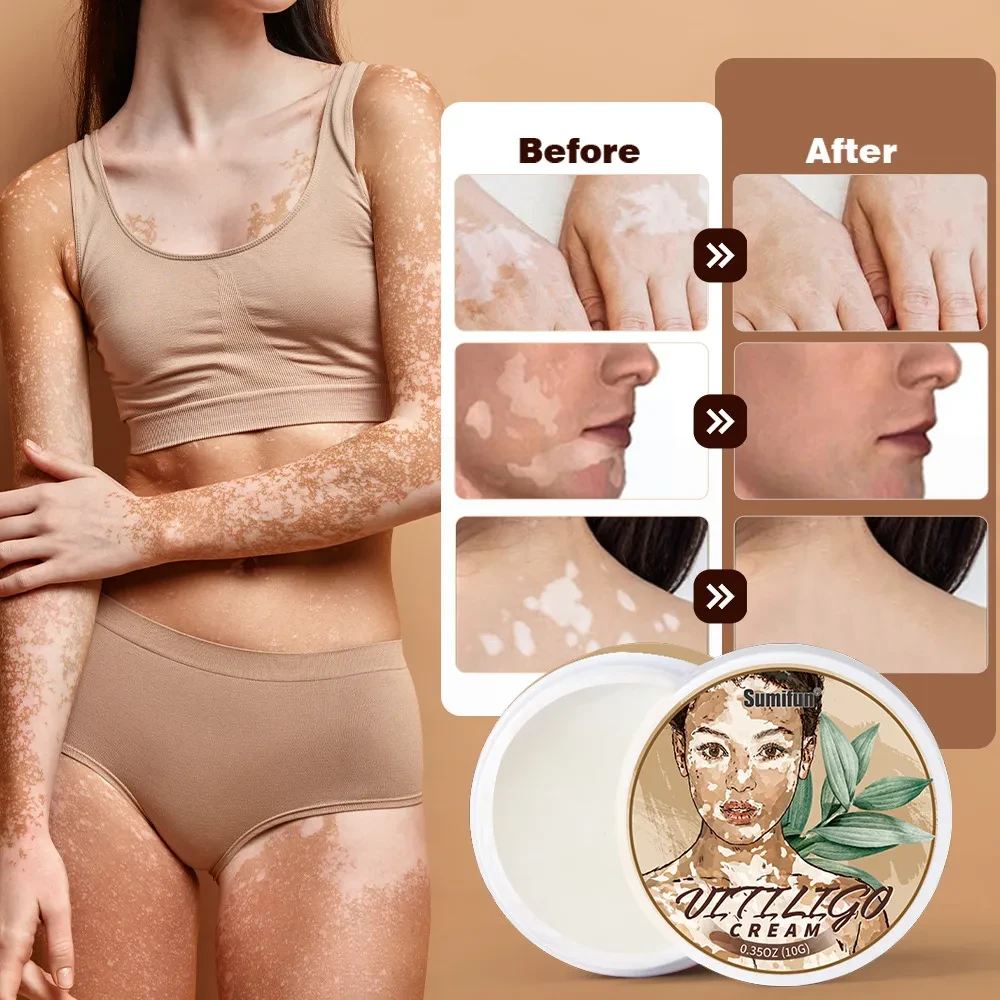 White Spot White Skin Antibacterial Cream