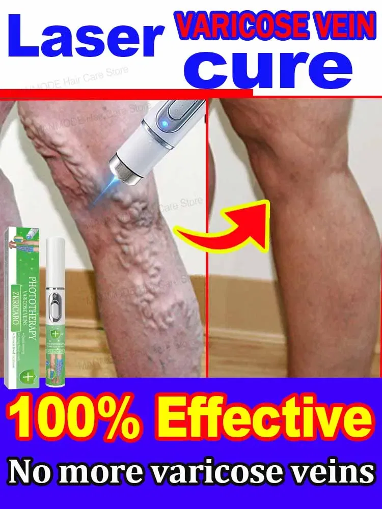 Color: Blue - Varicose Veins Products