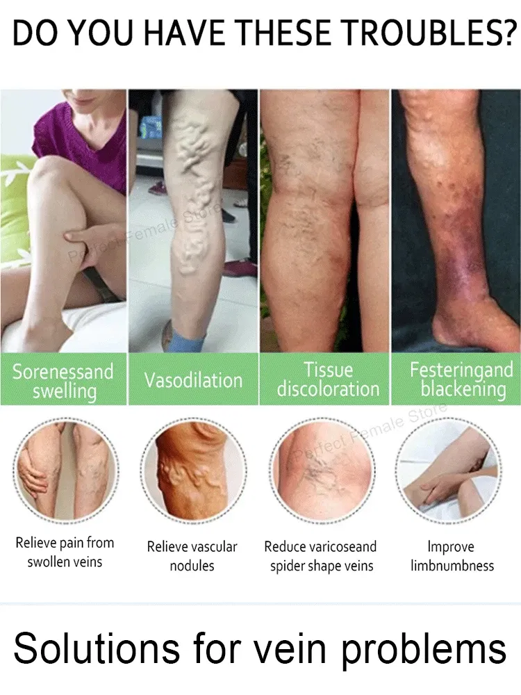 Color: green - Varicose Veins Products