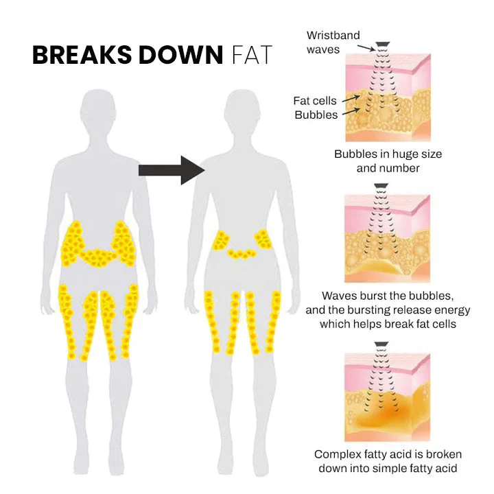 Seurico Matteo Ultrasonic Body Shape Wristband Pro