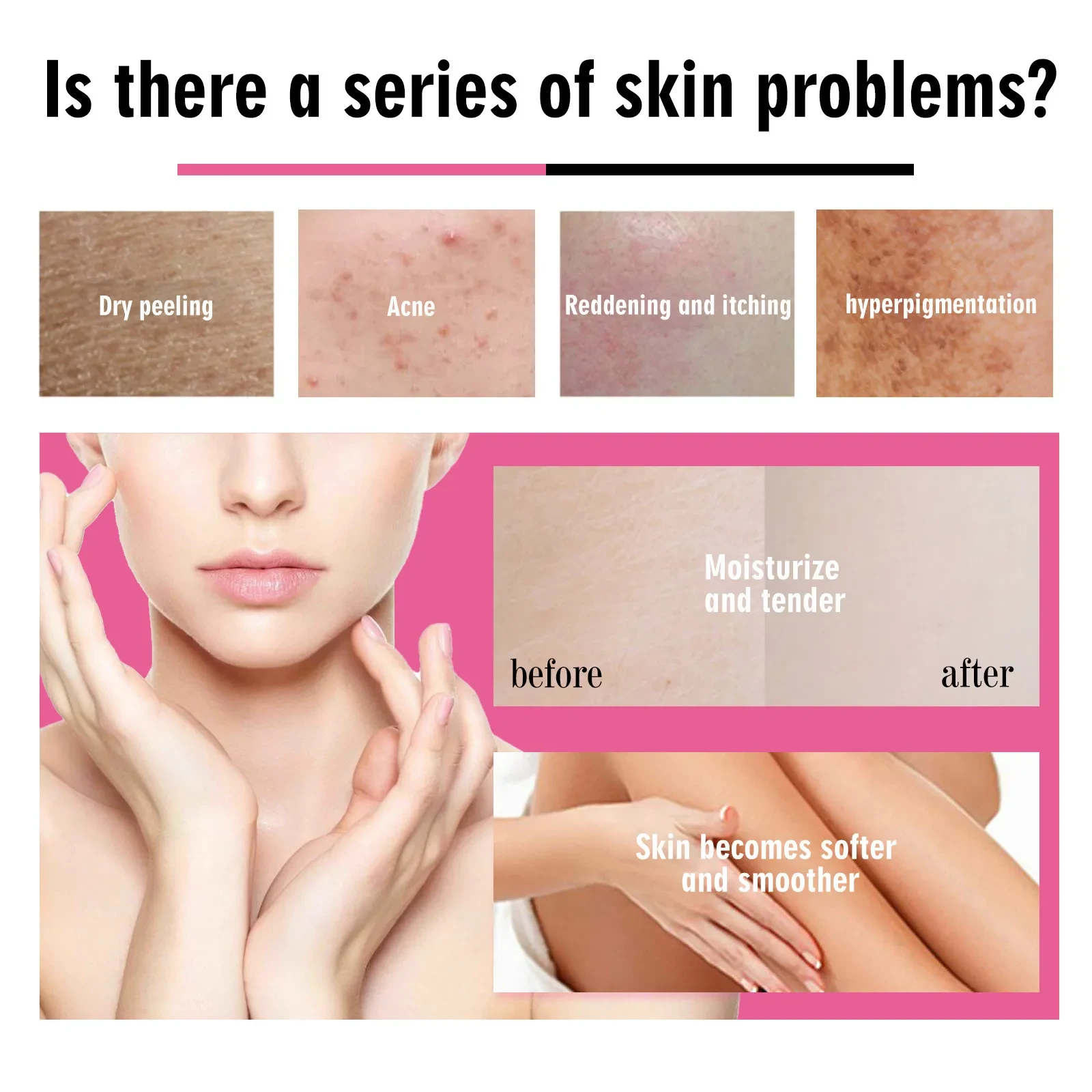 Body Treatment Oil Dry Skin Nourishing Moisturizing