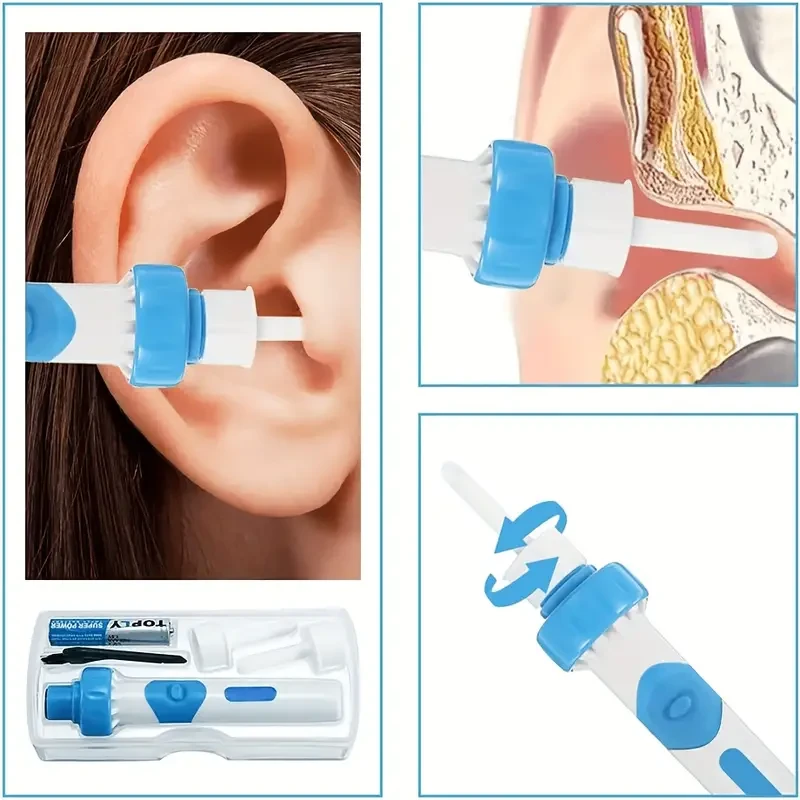 ProClean Ear Wax Removal Kit - Safe, Painless and Gentle Ear Cleaner for Effective Wax Removal - Easy to Use and Comfortable Design