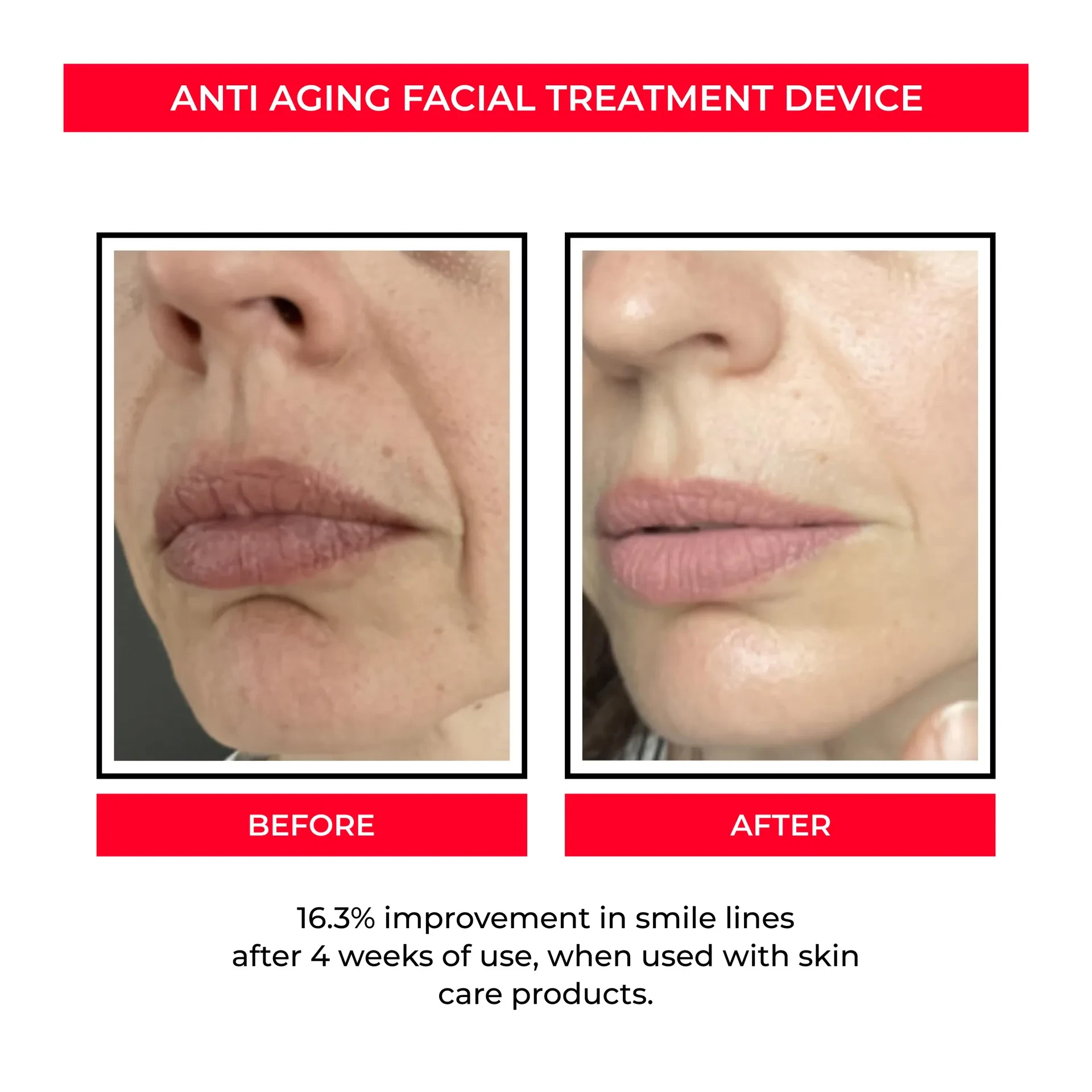 EMS Skin Rejuvenation Device with Microcurrent for Pore Tightening and Skin Firming
