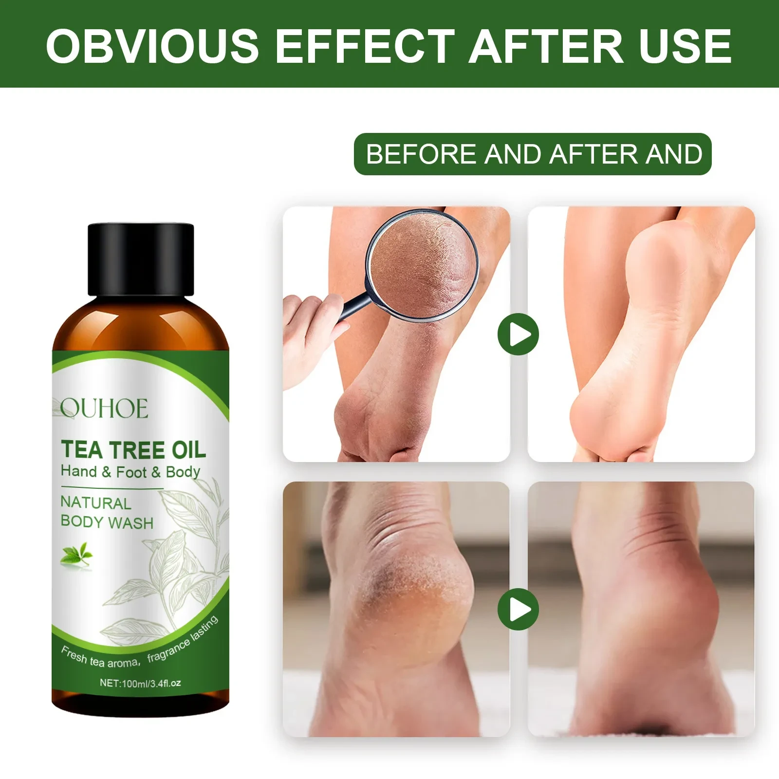 Foot Heel Calluses Crack Exfoliating Skin Care