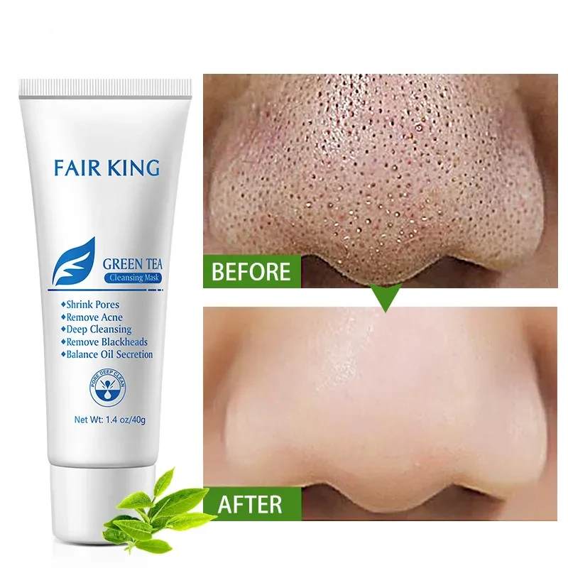 Green Tea Mask To Remove Blackheads And Oil