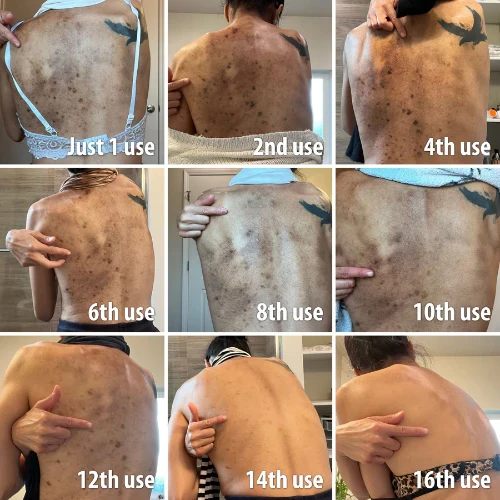 AQA Melanin Correcting Brightening Serum - Advanced Anti-Aging & Dark Spot Treatment