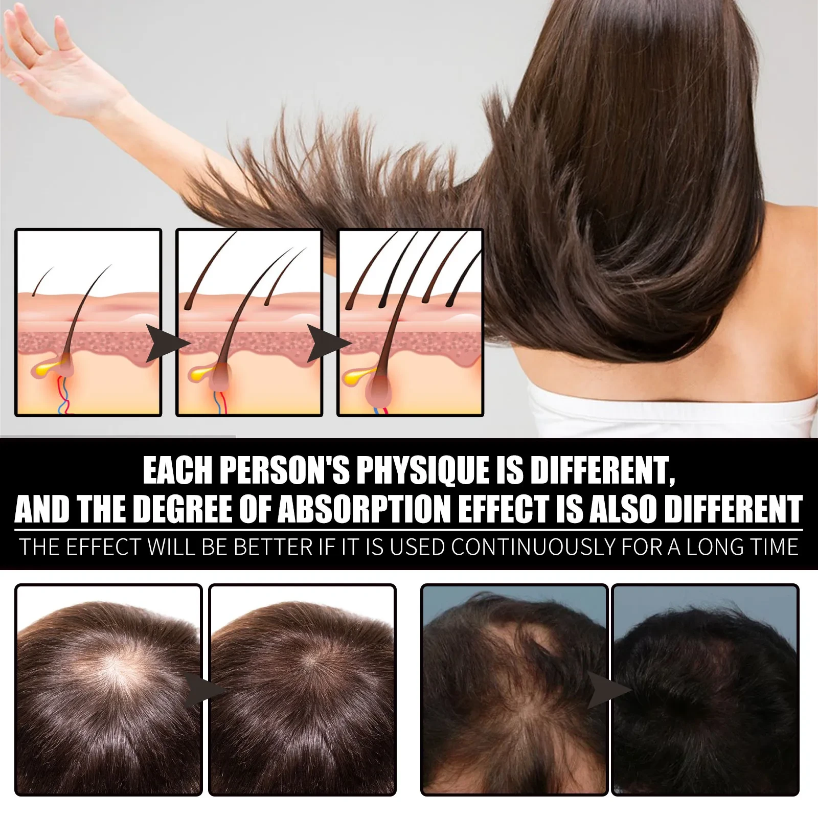 OUHOE Collagen B7 Vitamin Hair Oil Hair Strengthening