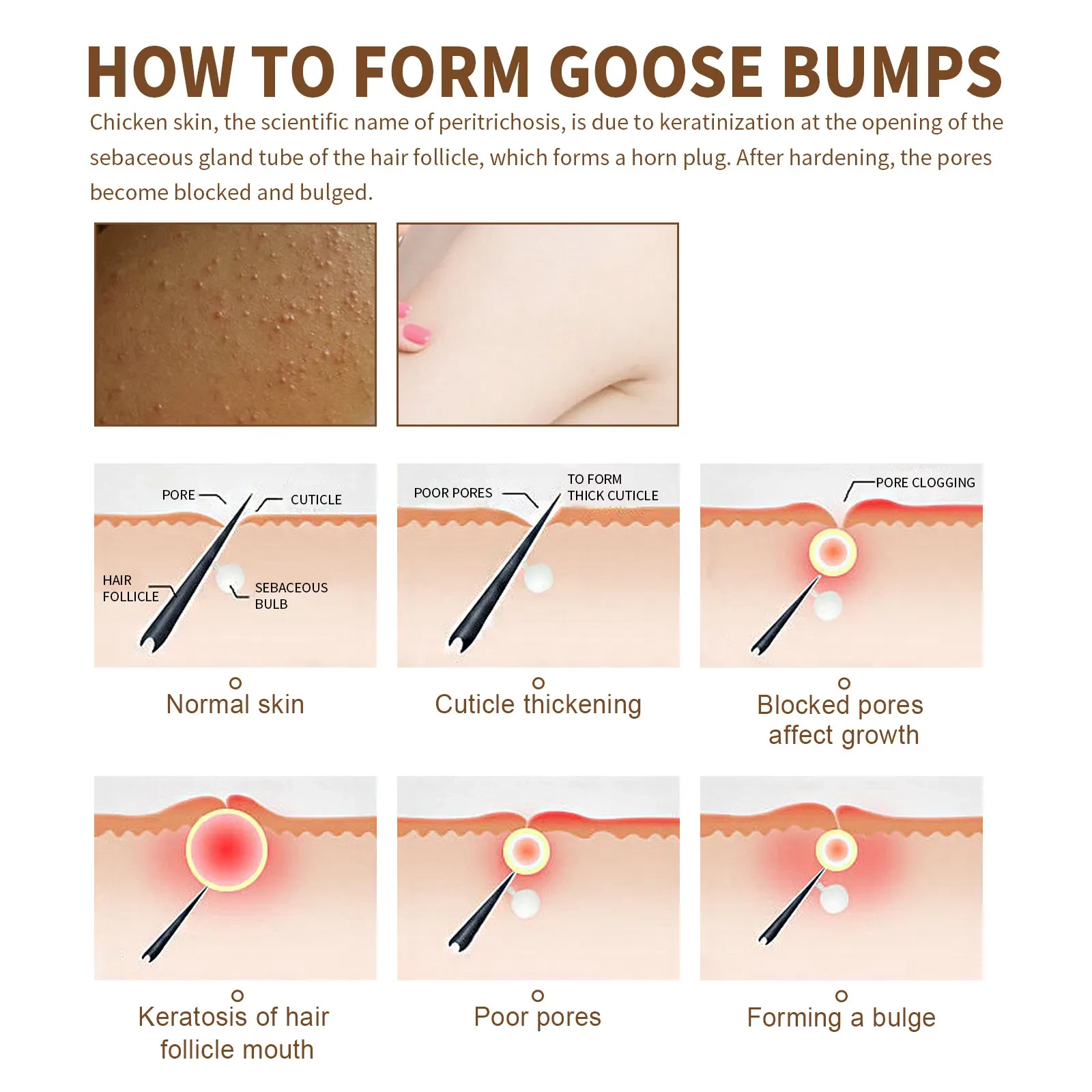 Chicken Skin Repair Cream Hair Follicle Cutin