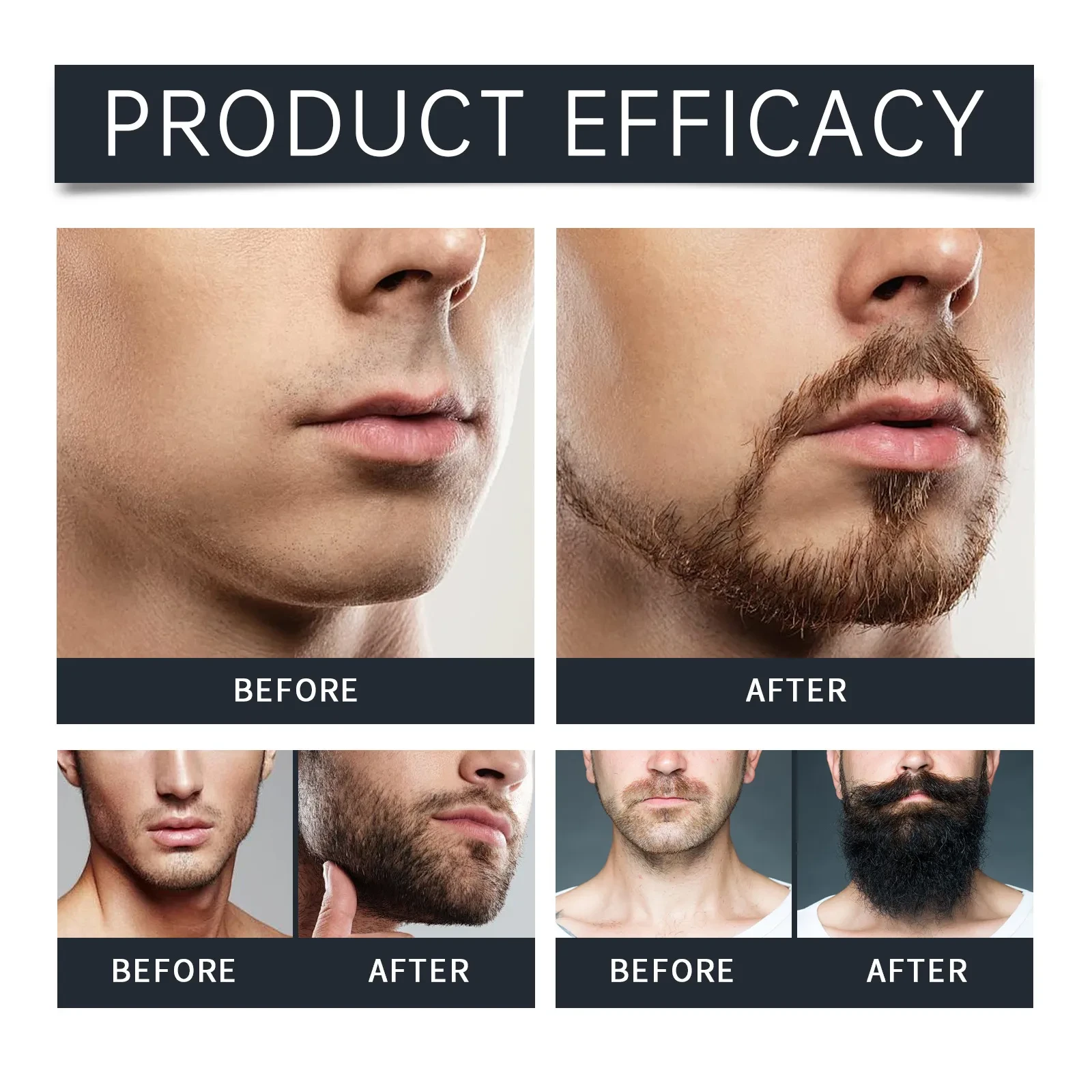 Beard Cleaning Mousse Moisturizing Care