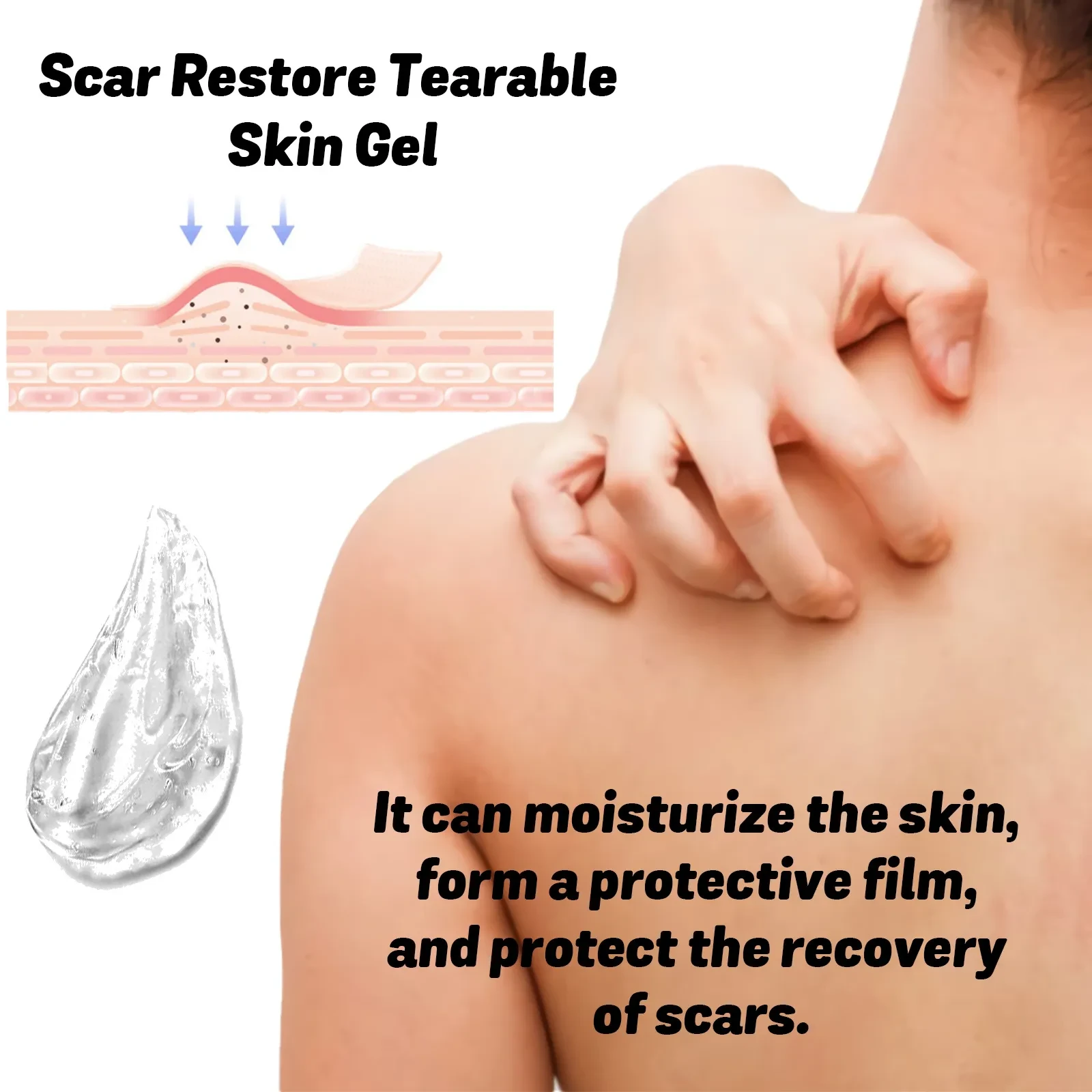 Skin Thinning Care Gel For Scar
