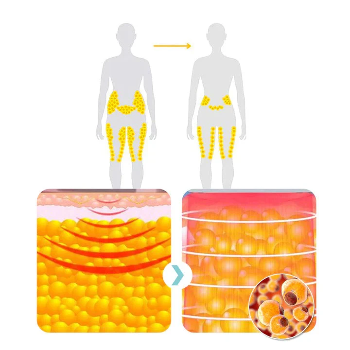 Seurico Matteo Ultrasonic Body Shape Wristband Pro