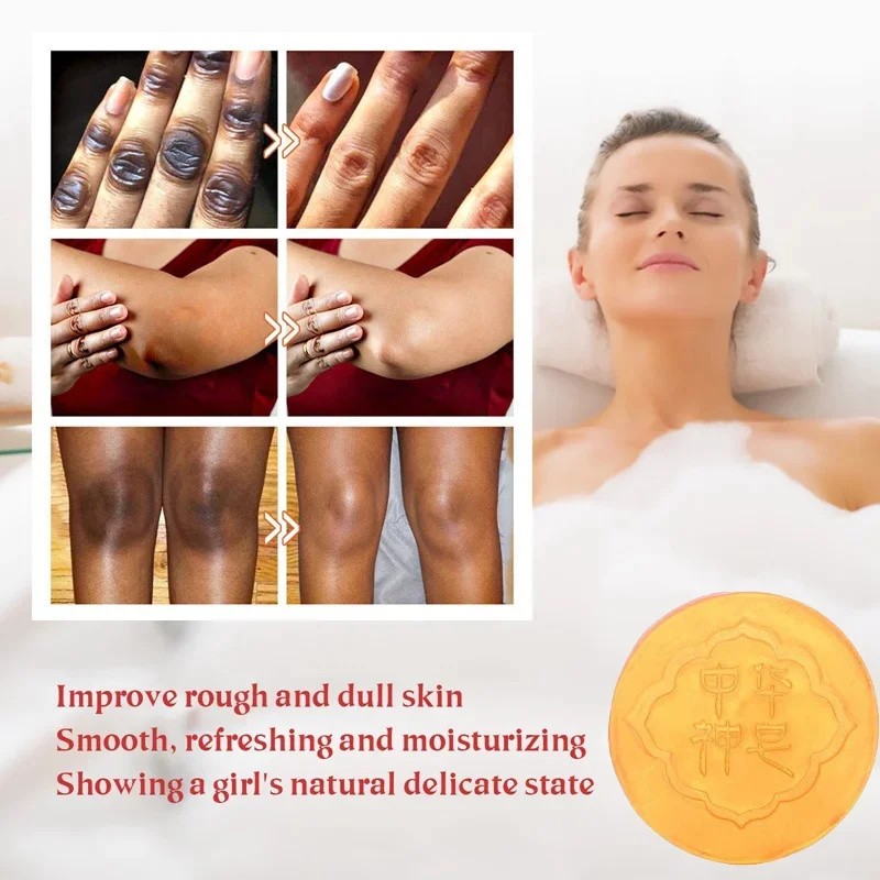 Body Whitening Soap - Deep Clean Skin and Chicken Skin Removal