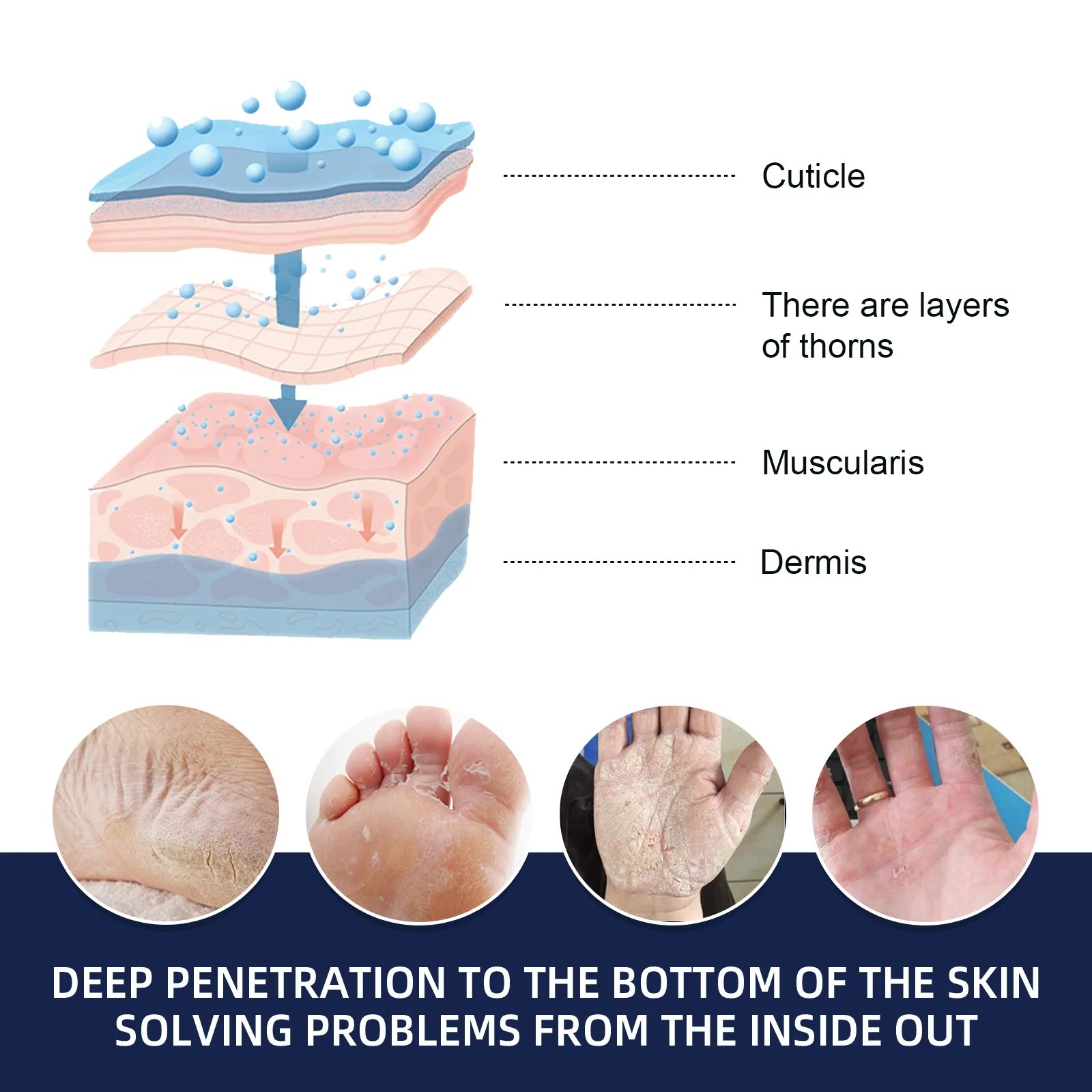 Anti-Drying Crack Hand & Foot Care Cream - Heel Repair & Skin Moisturizer