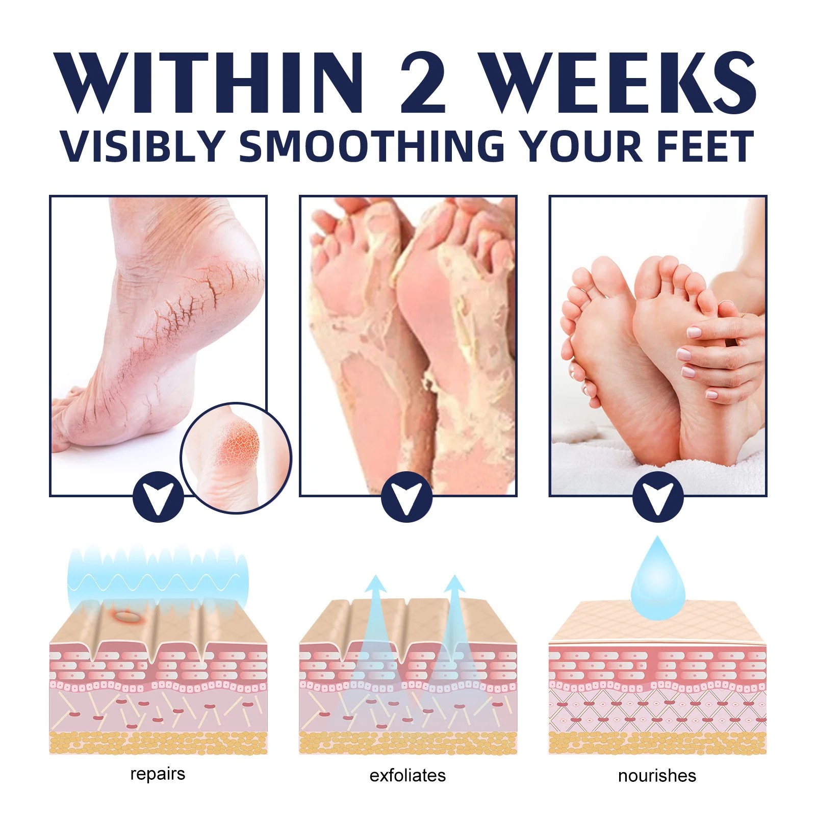 Anti-Drying Crack Hand & Foot Care Cream - Heel Repair & Skin Moisturizer