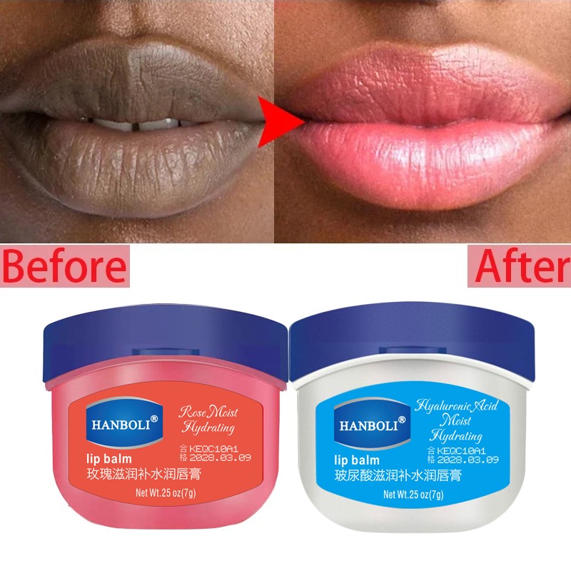 Remove Dark Lip Balm - Lightening & Moisturizing Korean Lip Care