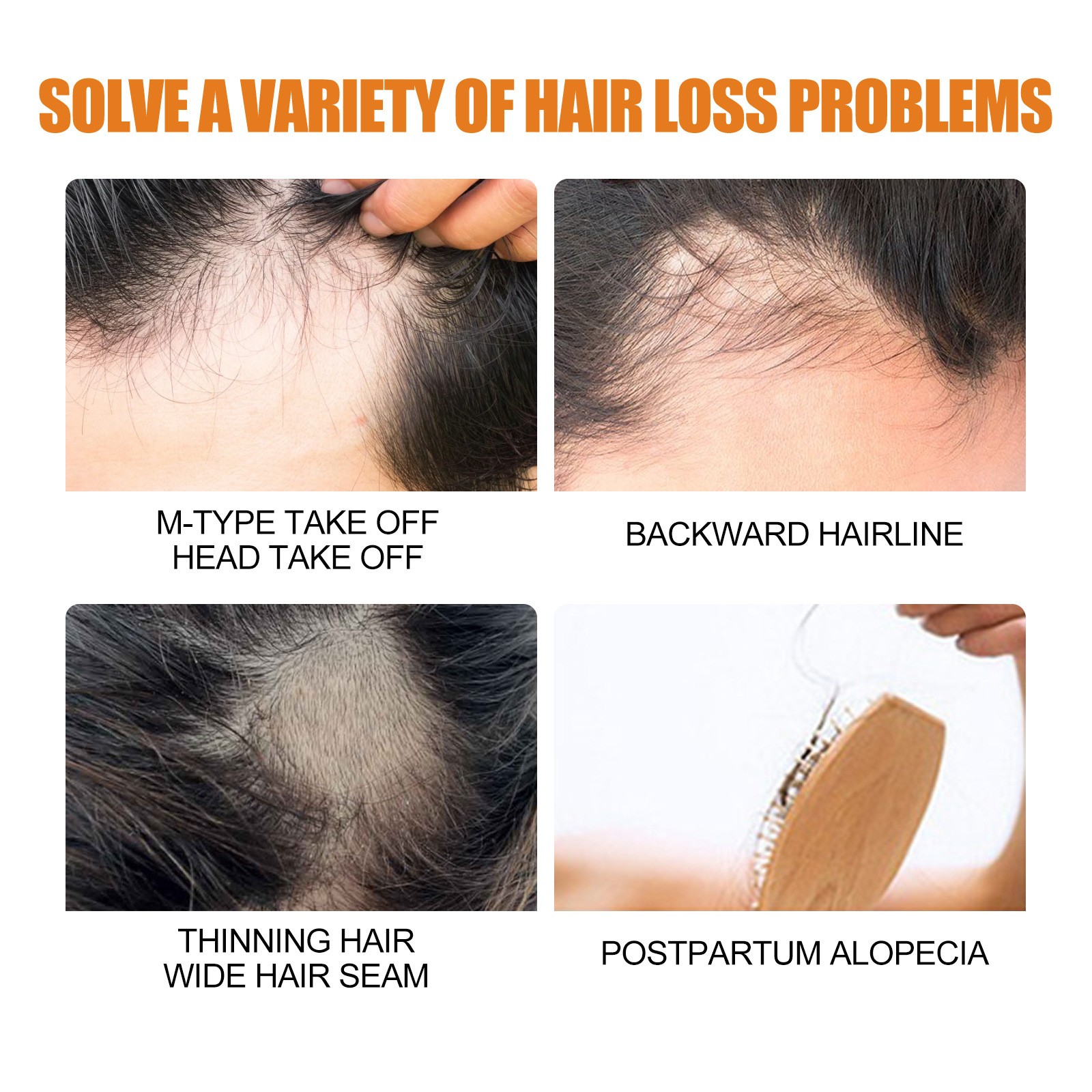 Hair Growth Serum Spray - Anti Hair Loss and Fast Growing Hair Care