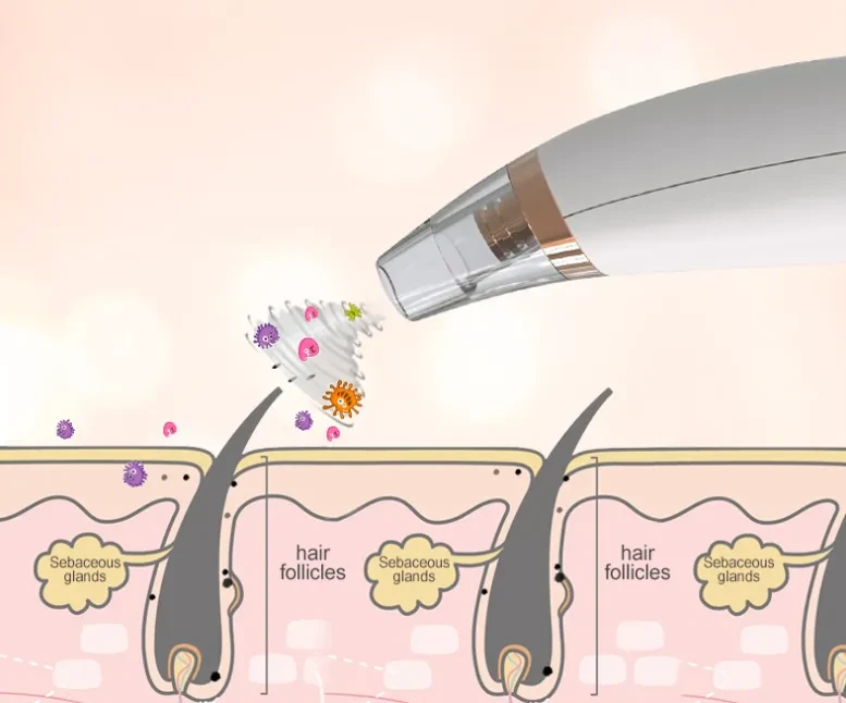 Electric blackhead meter